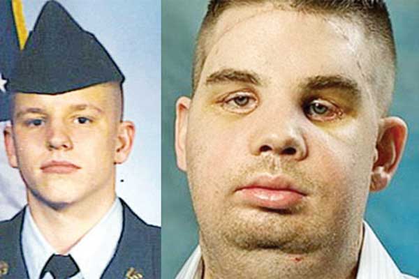 زندگی مردی که چهره نداشت(+ عكس)